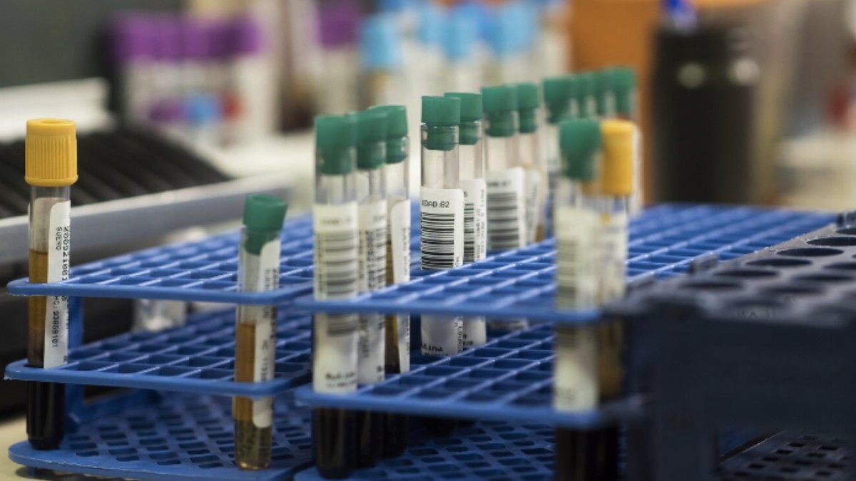 Mostres en un laboratori